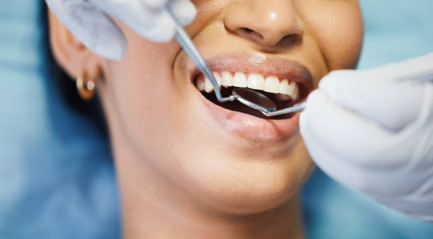 Best Emergency Tooth Extraction in Hereford, TX